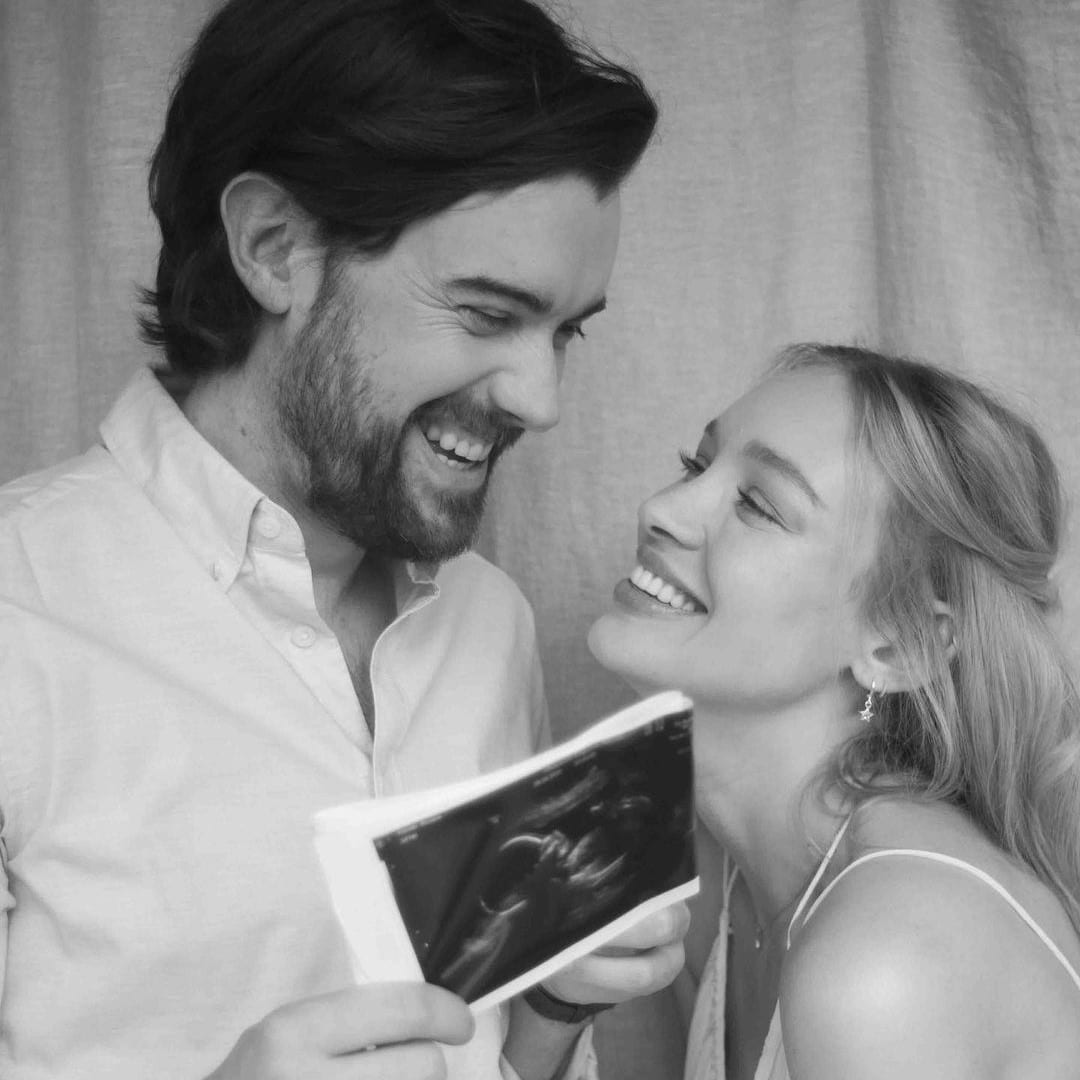 Actor and Comedian Jack Whitehall Expecting 1st Child with Partner Roxy